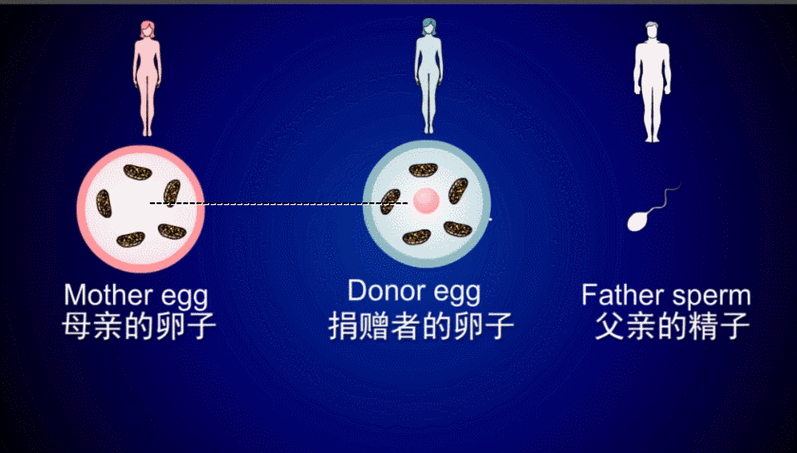 第四代试管婴儿