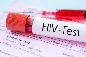 HIV试管