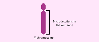 试管检查 AZF