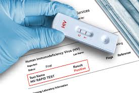 HIV阳性代孕